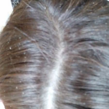 Avalon Organics Shampoo Hair Scalp Care - فر,ة الرأس ,العناية بالشعر ,الشامب,العناية بالشعر