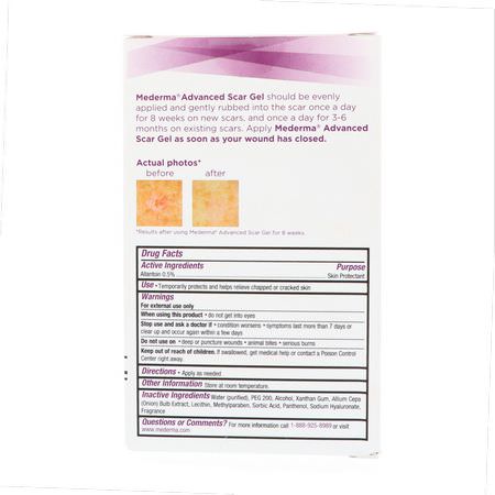 Mederma, Advanced Scar Gel, 1.76 oz (50 g):الند,ب ,علامات الإمتداد